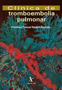 Clínica de tromboembolia pulmonar