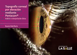 Topografía corneal por elevación mediante Pentacam®