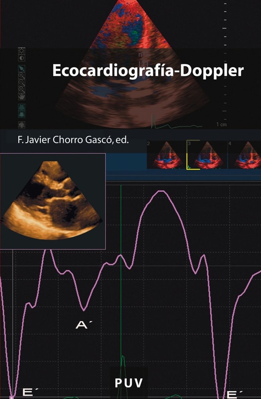 Ecocardiografía-Doppler