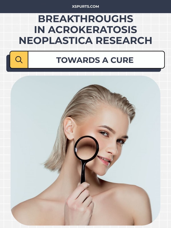 Breakthroughs in Acrokeratosis Neoplastica Research