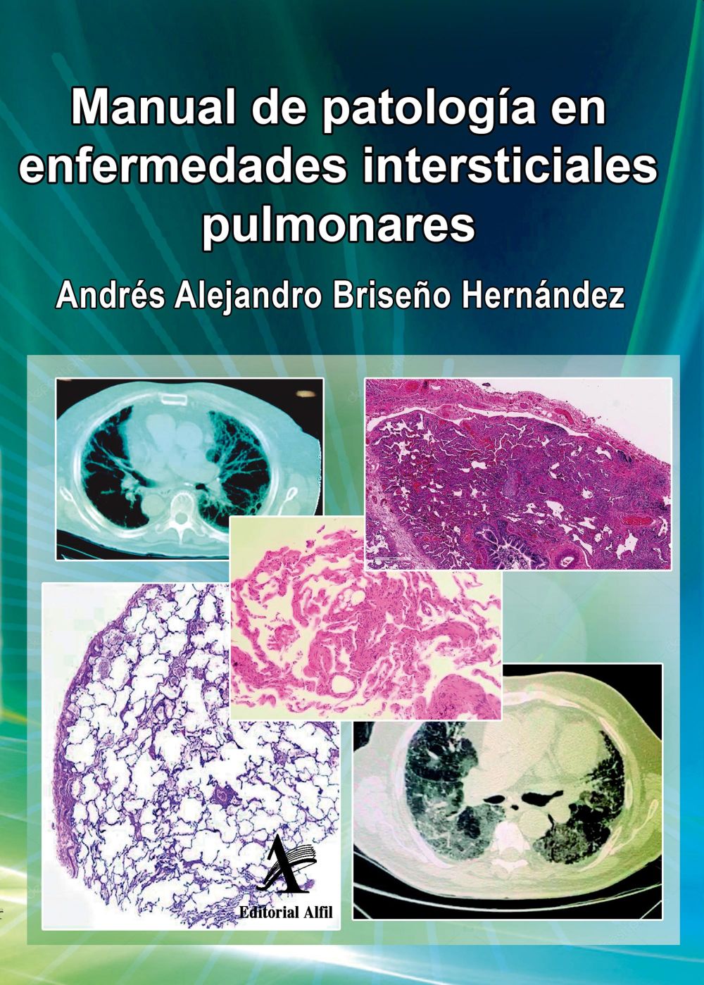 Manual de patología en enfermedades intersticiales pulmonares